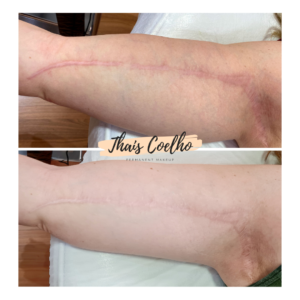 20211103_171928_0000