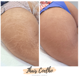 png_20220331_160736_0000