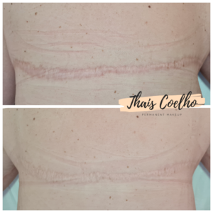 png_20220217_175321_0000 (1)