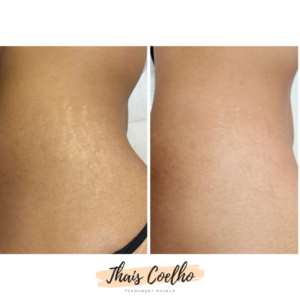 20210902_120316_0000