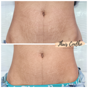 20220420_161552_0000