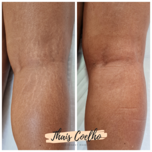 C10B05CB-21CD-4F97-B225-34162792419C